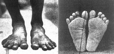 [Image: 1905-barefeet.jpg]